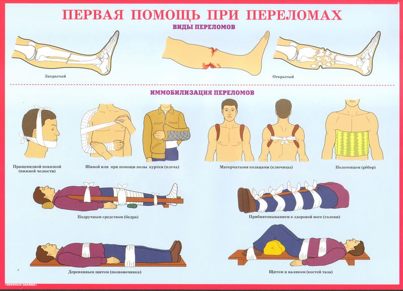 Первая помощь при переломах Первая помощь при переломах