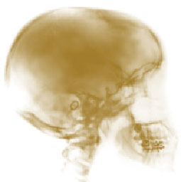 Краніосакральна терапія Краніосакральна терапія