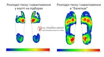 Навантаження стопи у взутті