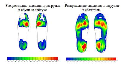Нагрузка стопы в обуви