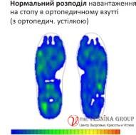 Розподіл навантаження на стопу