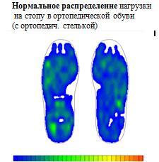 Распределение нагрузки на стопу