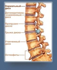 Фрагмент позвоночника